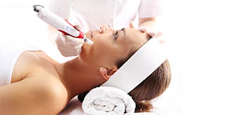 Skin Needling