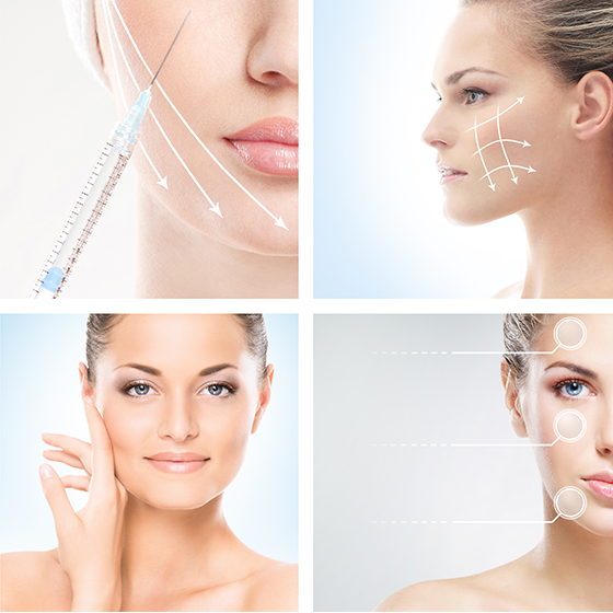 Wrinkle Injections London